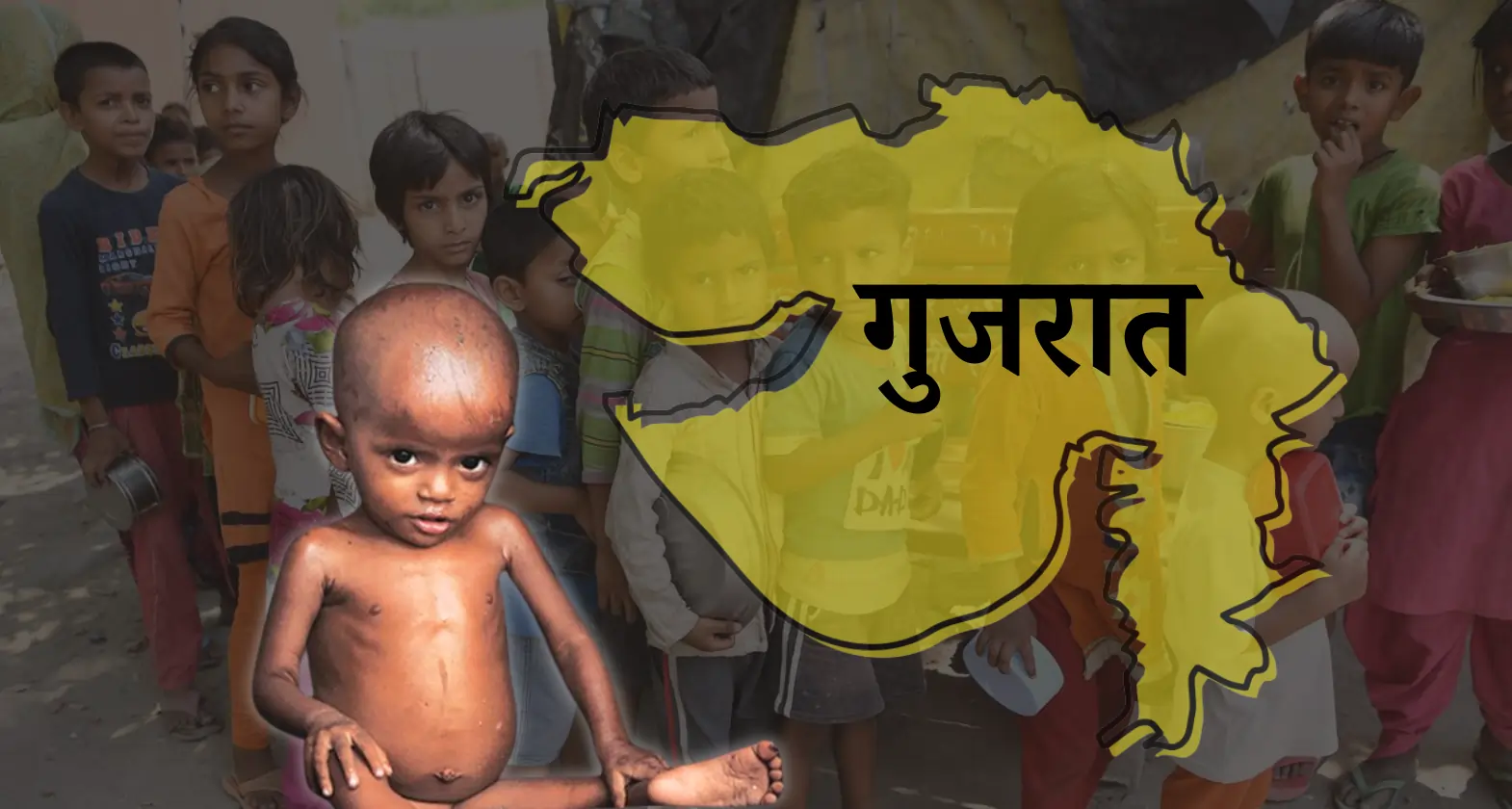 gujarat malnutrition