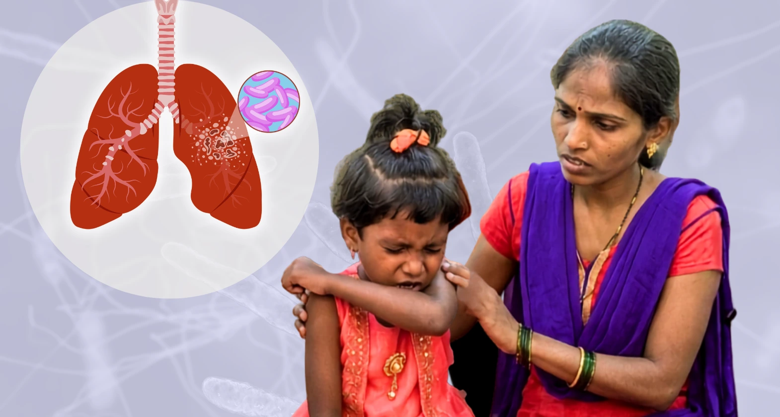 tb in children